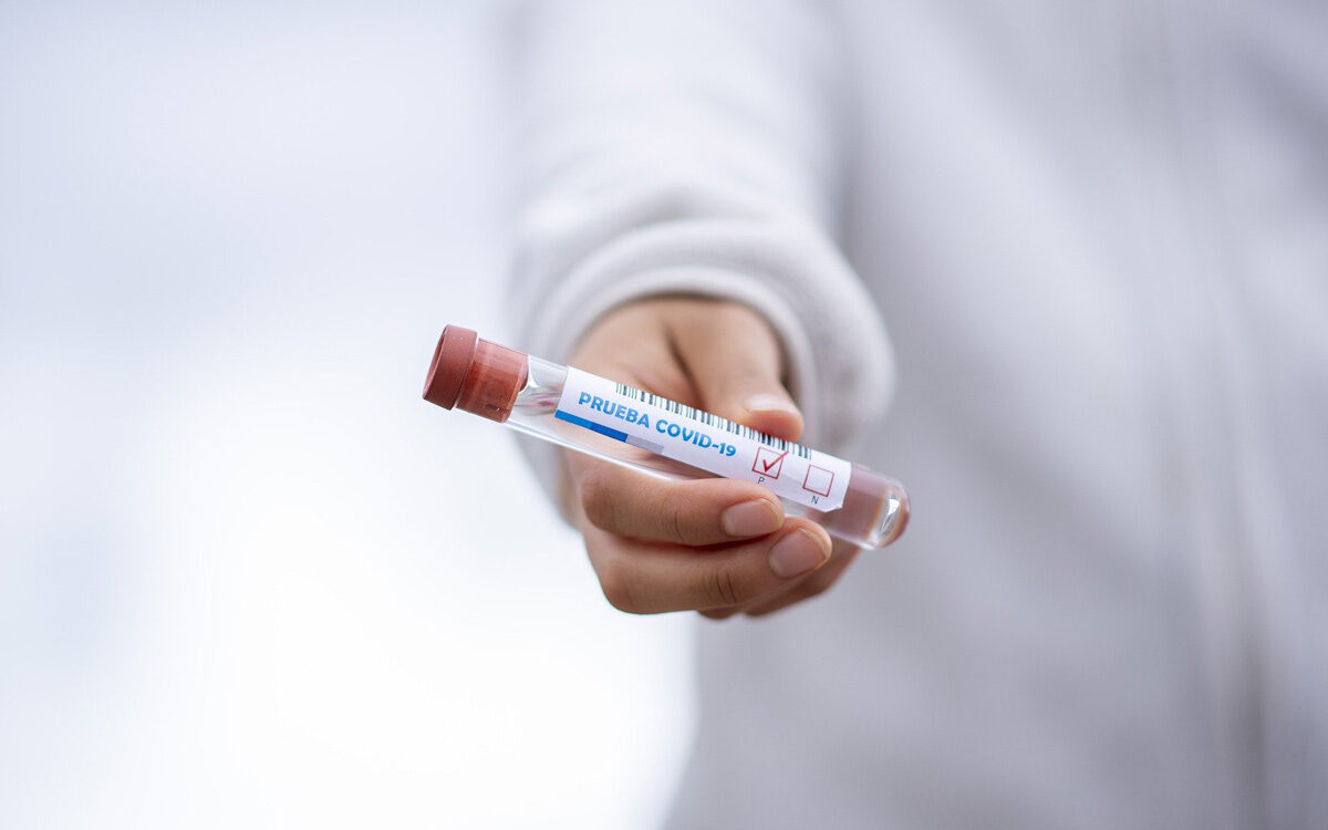 Eine Laborprobe eines Coronavirus in der Hand eines Arztes Eine Laborprobe eines Coronavirus in der Hand eines Arztes